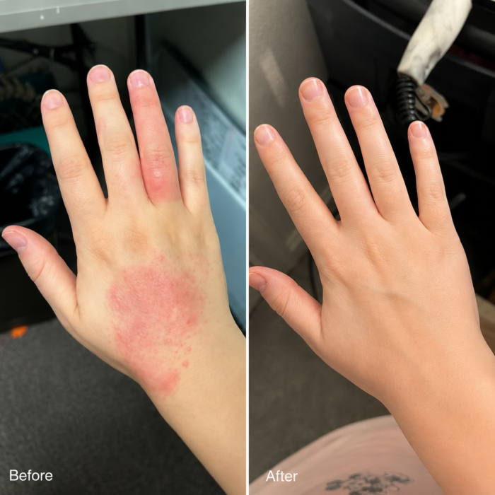 Crème Dermatite & Peau Saine – Soulage démangeaisons, rougeurs et desquamation 50ml – Image 9
